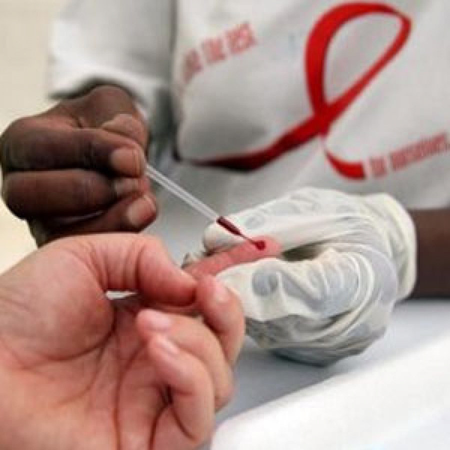 El tratamiento inmediato tras diagnóstico de VIH reduce riesgos en un 57 %