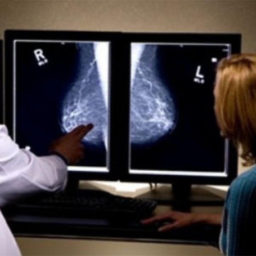 Investigadores presentan avances para pronosticar cáncer de mama
