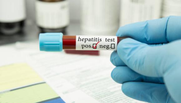 De qué trata la misteriosa hepatitis detectada por la OMS